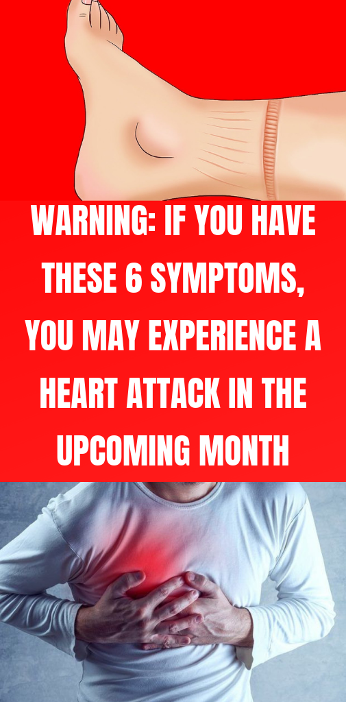 Can You Survive A Mild Heart Attack Without Treatment